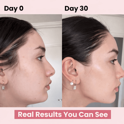 DermaSculpt RF - Luxrelivo