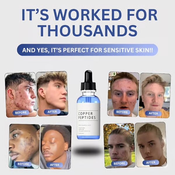 GHK - Cu Copper Peptide Serum – Skin Barrier Support & Hydration – 29ml - Luxrelivo