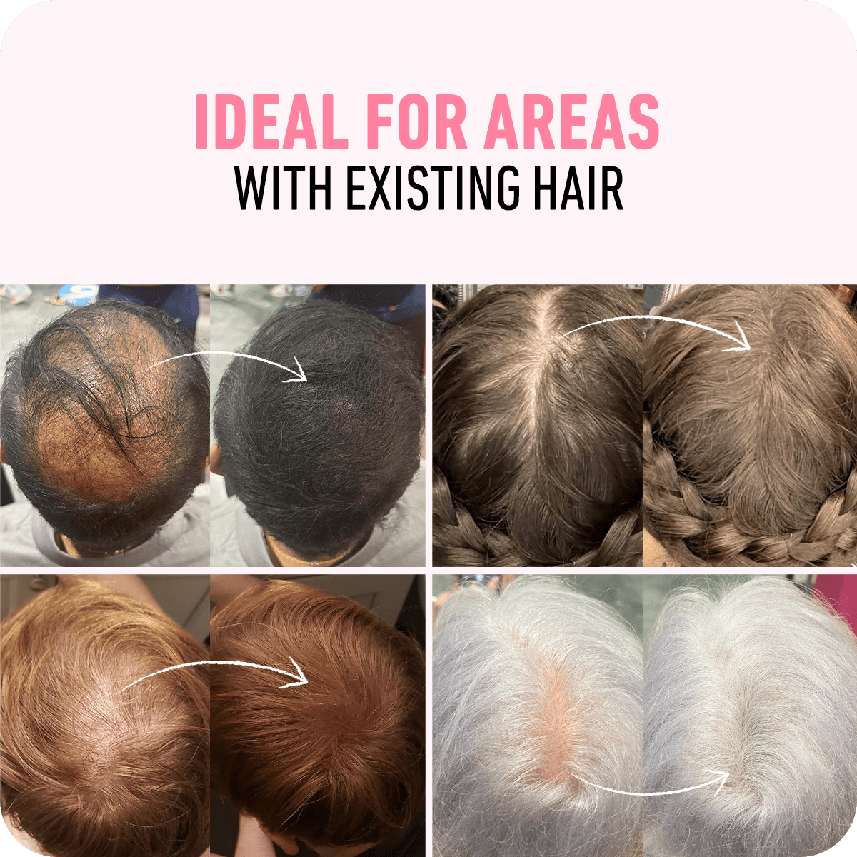 Hair Thickening Fibers - Luxrelivo
