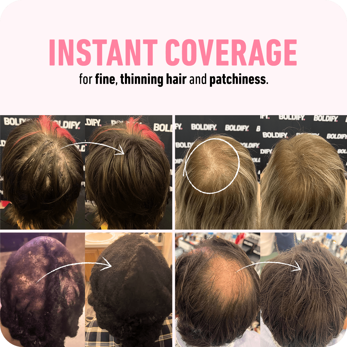 Hair Thickening Fibers - Luxrelivo